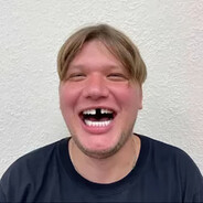 ЖиробaZZZ S1mple