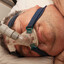 CPAP