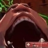 Hex: Huntress' Thighs