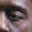 Forest Whitaker's droopy eye