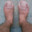 TheToe