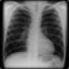 cxr