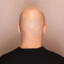 Bald