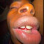 freelipe