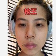 脑袋瘙痒想吃弹