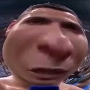 Начёс на яйцах