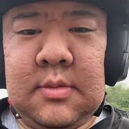 王志鹏嗦甲沟炎