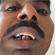 Abdi From Congo