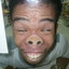 Major retard