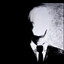 SlenderMan
