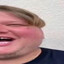ple