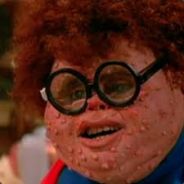 McSkip