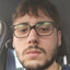 Tengo Fimosis