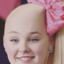 Jojo Siwa&#039;s receding hairline