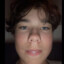KROBBEN KING