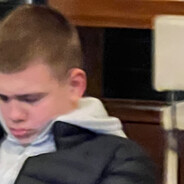 Клитор доли