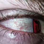 DAGESTAN暁PEEK skyfocus