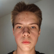 Albertman