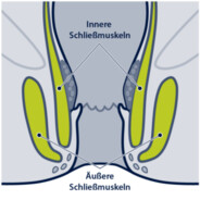 Schießie Schließmuskel