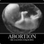 a50storyAbortion