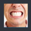Show the teeth &quot;OLHA O BÁFO&quot;