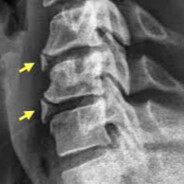 backpain - steam id 76561197960780180