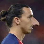Zlatan's nose