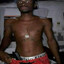 Subrin