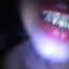 Paracetomol