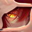 Fox_snape