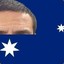 Timmy Cahill&#039;s forehead