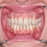 #qui pourra me vaincre deformer