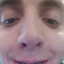 ODD1V