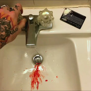 #Overdose&amp;drug taking