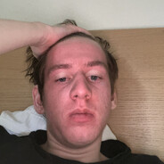 Spitznase 3 - steam id 76561198283208646