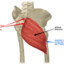 Gluteus Maximus