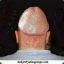 Dick HeaD