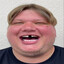 Pohl