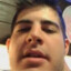 Cancer Cebero
