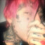 Pain