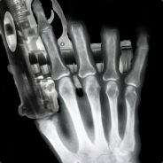 Funny Bone