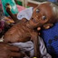 starving african child