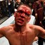 Nate Diaz