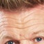 Gordon Ramsay&#039;s forehead