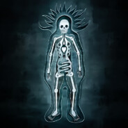 somberlain - steam id 76561197962385915