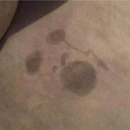 Лох пидальный