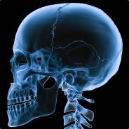 X-Ray