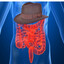 Indiana Crohns