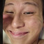 샤코민영