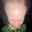 Nr. 1 Forehead